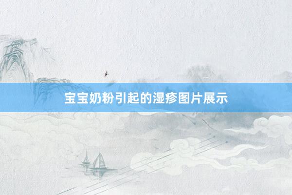 宝宝奶粉引起的湿疹图片展示